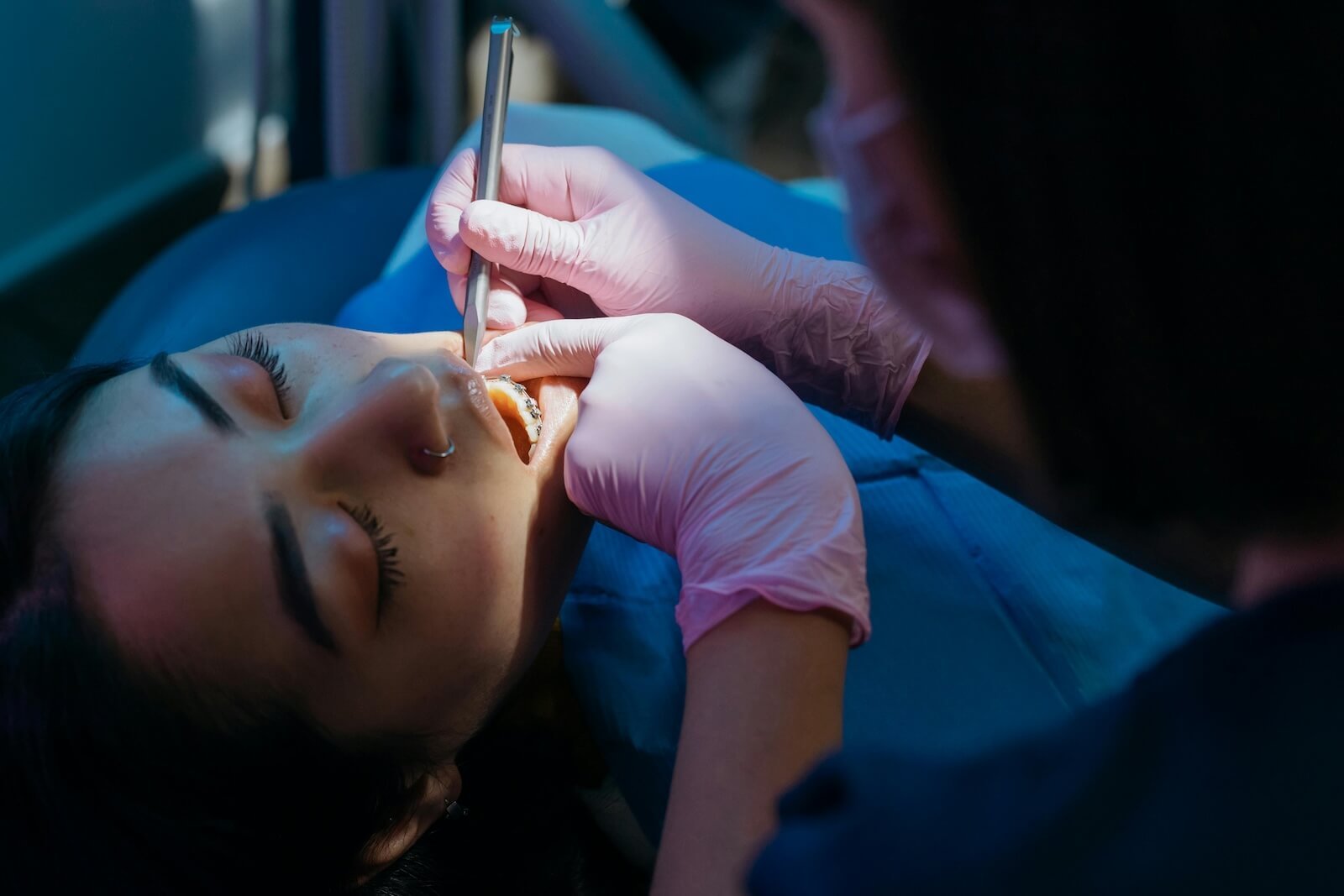 How Often Should You Get Your Teeth Professionally Cleaned?