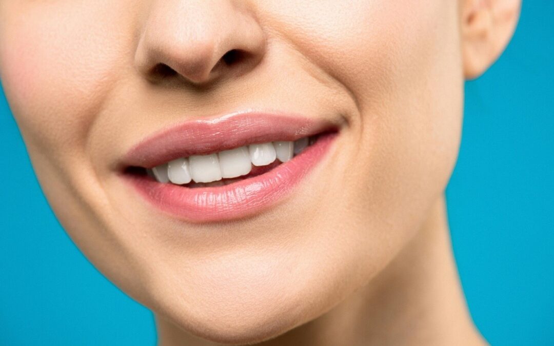 Top Benefits of Professional Teeth Whitening Over At-Home Kits