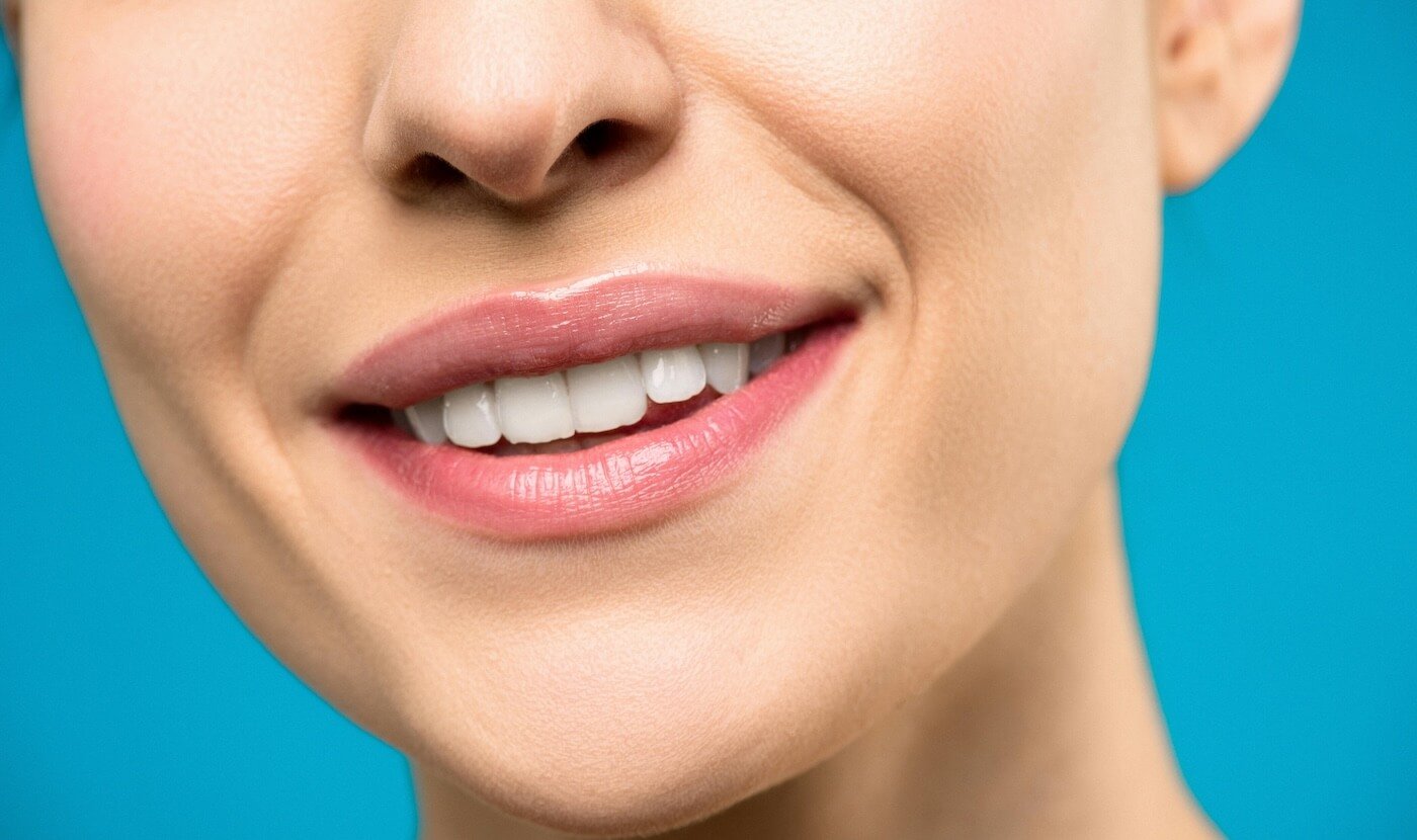 Top Benefits of Professional Teeth Whitening Over At-Home Kits